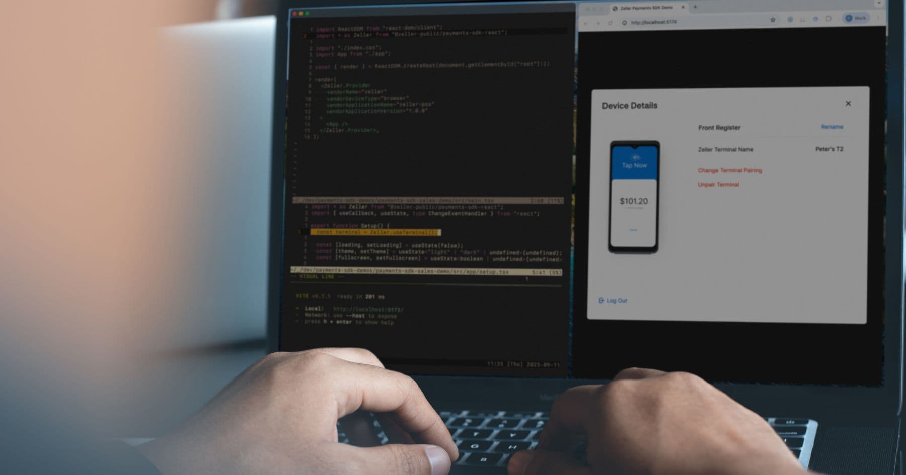Build It Your Way: How Zeller's Open SDK Is Changing What Developers Can Do With Payments